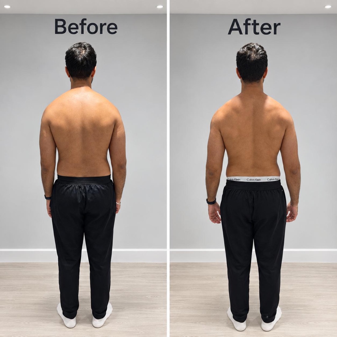 Client's back before and after posture correction: shoulders sit more level and the upper back looks more open after treatment