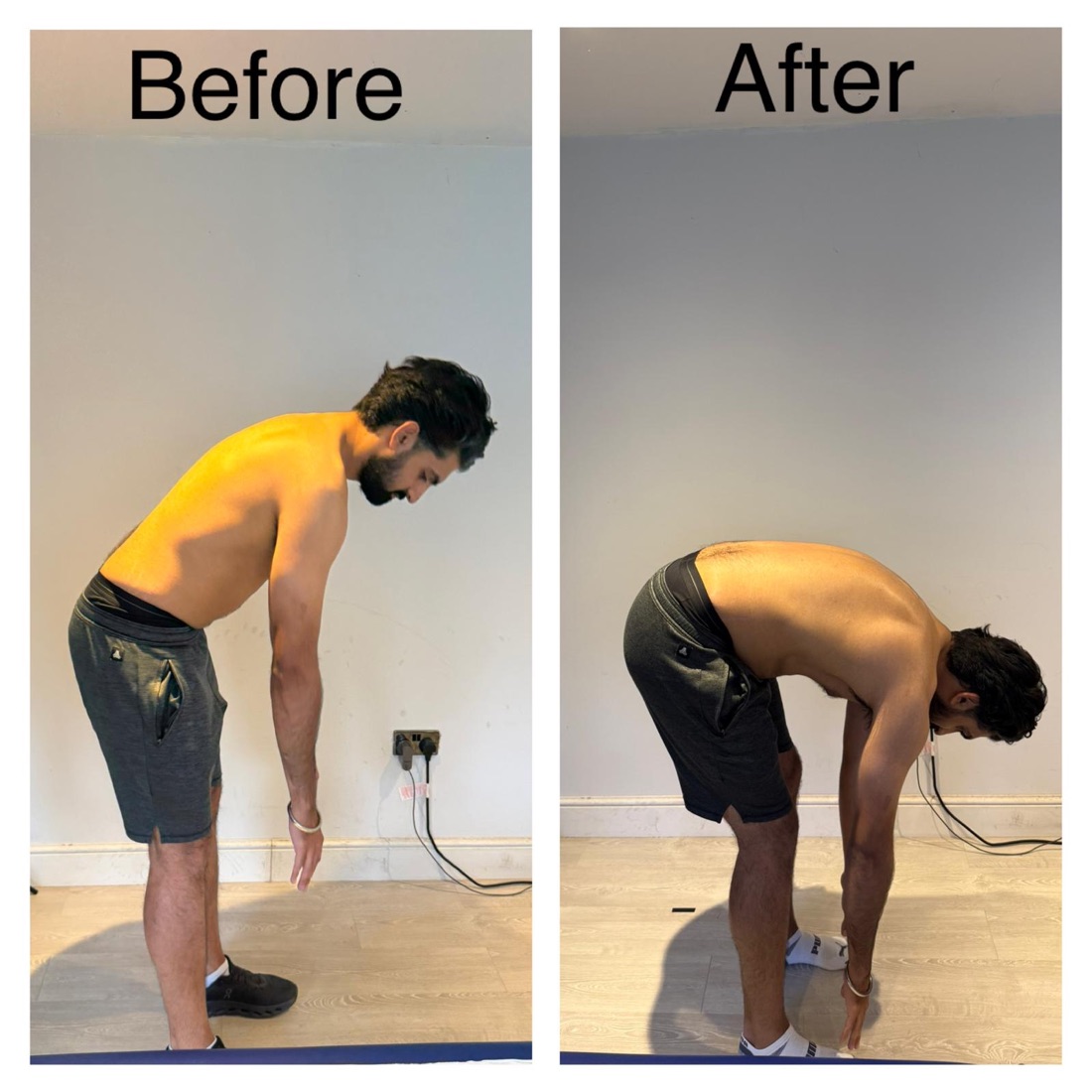 Client bending forward before and after treatment for sciatica and back pain: before, the hands stop at the knees; after, the fingertips reach the floor