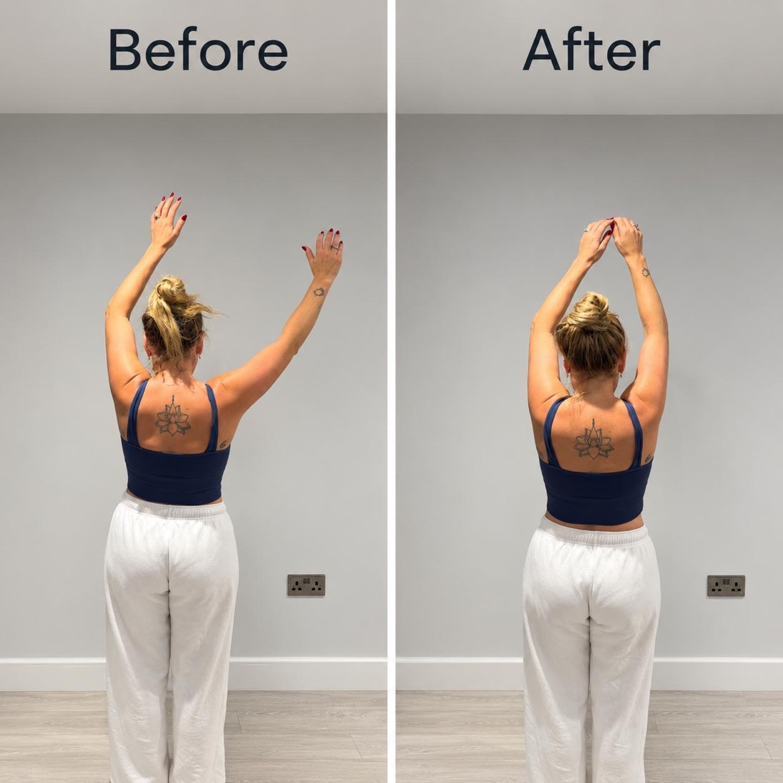 Client raising both arms before and after treatment for shoulder impingement: before, the arms cannot meet overhead; after, the hands meet above the head